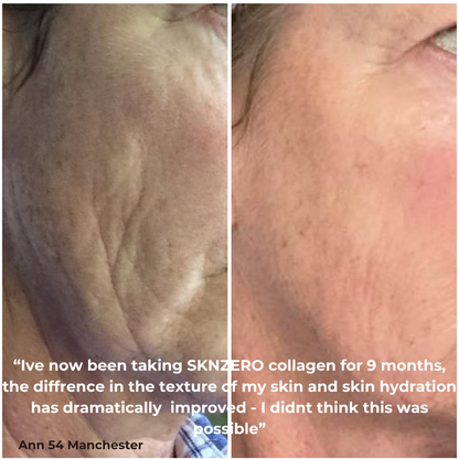 SKNZERO Premium Liquid Marine Collagen 10,000mg